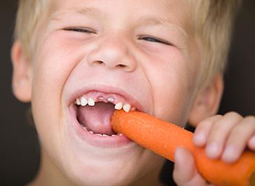 Pulizia dei denti dei bambini e alimentazione. I consigli del dentista di Pescara Paolo Fulgenzi